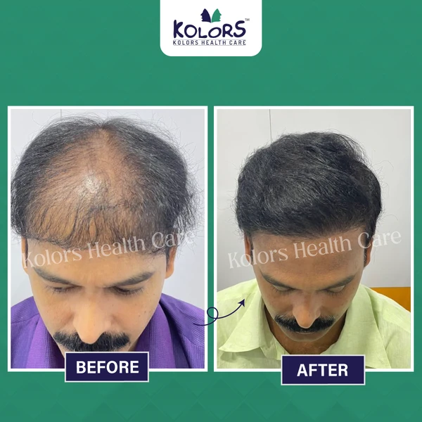 Hair Care Treatment Before and After