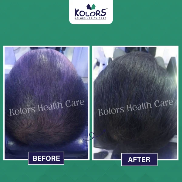 Before and
                After Hair Treatment