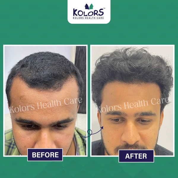 Before and
                After Hair Treatment
